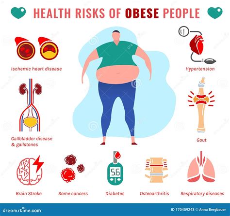 Obesity (Excessively Overweight): Health Effects and。